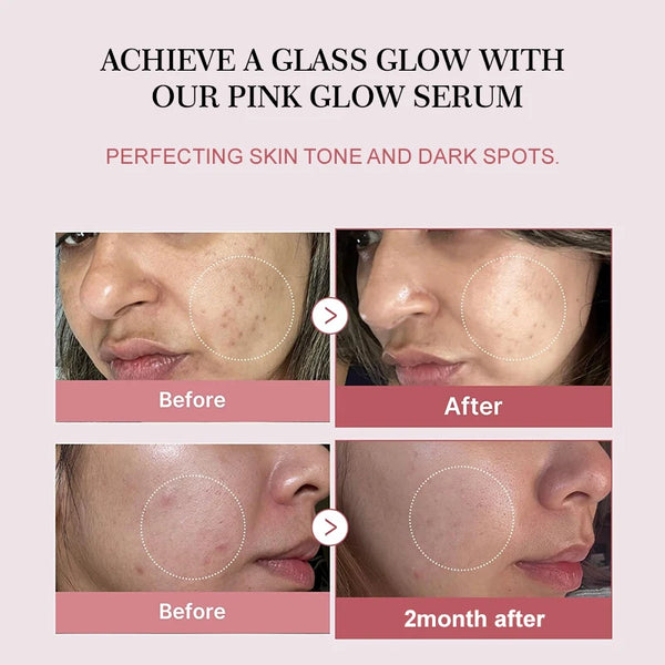 Collagen-Peptide-Facial-Serum-Targets-Dull-Skin-Boosts-Skin-Elasticity-Stimulates-Skin-Renewal-Repair-Salmon-PDRN.jpg